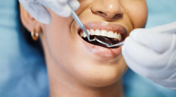 Best Emergency Wisdom Teeth Removal in Ocean View, DE